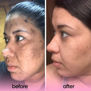 Turmeric Acid Cleaning Pads for Glowing Skin & Pore Cleansing
